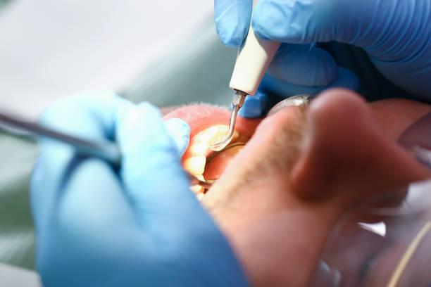 Best Same-Day Emergency Dentist in Whitmore Lake, MI