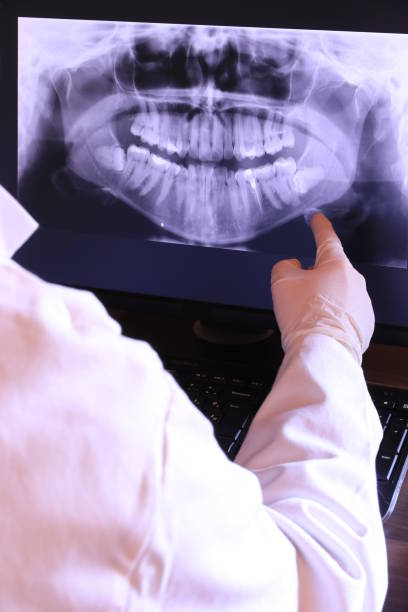 Best Emergency Tooth Extraction in Whitmore Lake, MI