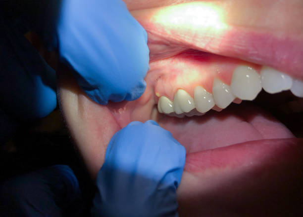 Best Emergency Root Canal Treatment in Whitmore Lake, MI