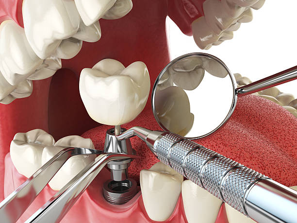 Best Emergency Treatment for Toothache in Whitmore Lake, MI