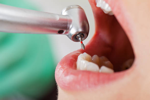 Best Walk-In Emergency Dentist in Whitmore Lake, MI